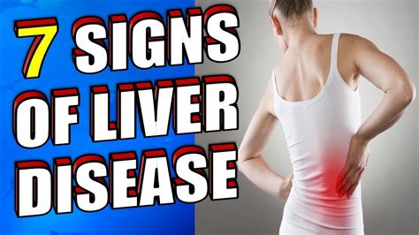 What Are The Early Signs Of Liver Disease Symptoms You Should Know