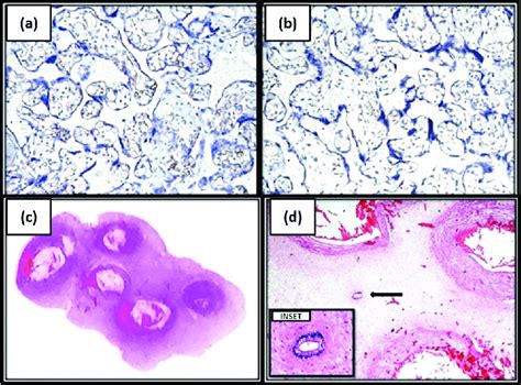 A 200x Immunohistochemically Stained Capillary Endothelial Cells