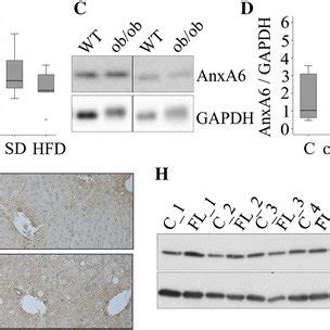 AnxA6 Protein Expression In Human And Murine Fatty Liver A AnxA6 In