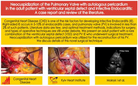 Chd Neocuspidization Of The Pulmonary Valve With Autologous Pericardium In The Adult Patient