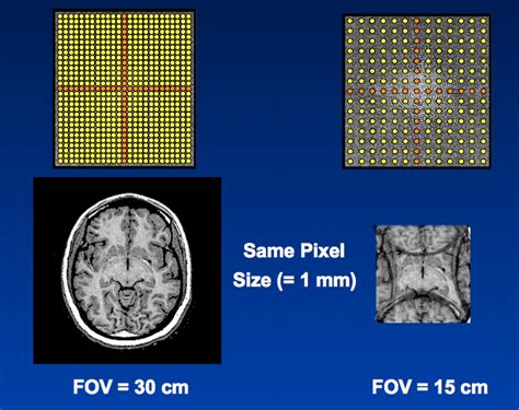 K Space FOV Questions And Answers In MRI