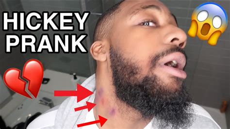 Hickey Prank On Girlfriend She Got So Upset Youtube