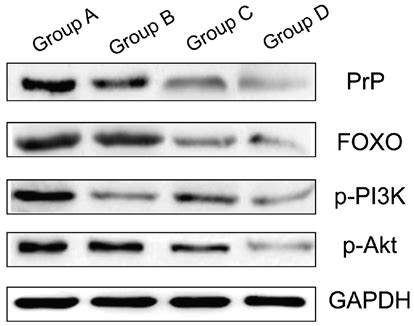 Western Blot Analysis Prp Prion Protein Fox Forkhead Box