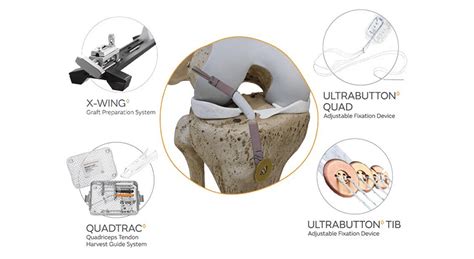 Smith Nephew Launches QUADTRAC Quadriceps Tendon Harvest Guide