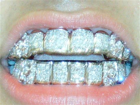 Pandora S Box Diamond Grillz Grillz Gold Grillz