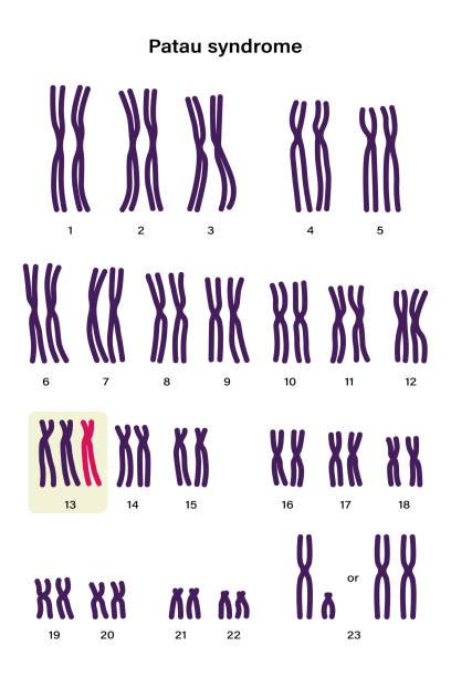 Human Karyotype Illustrations Royalty Free Vector Graphics And Clip Art