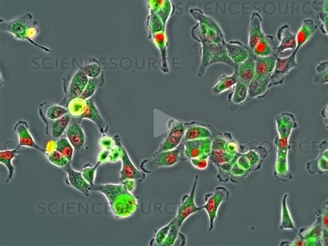 Human Cell Culture | Stock Video - Science Source Images