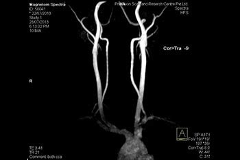 MRI Angio Neck - Precision Scan