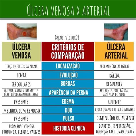 Resumo sobre as diferenças entre úlceras venosas x úlceras arteriais Med