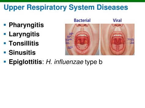 PPT - The Upper Respiratory System PowerPoint Presentation, free download - ID:3114458