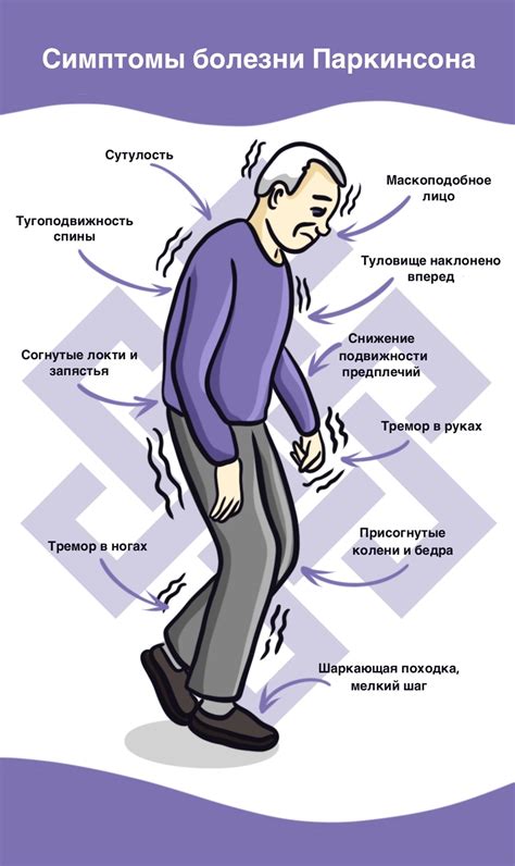 Болезнь Паркинсона лечение заболевания подходы и методы борьбы в России Как помочь больному