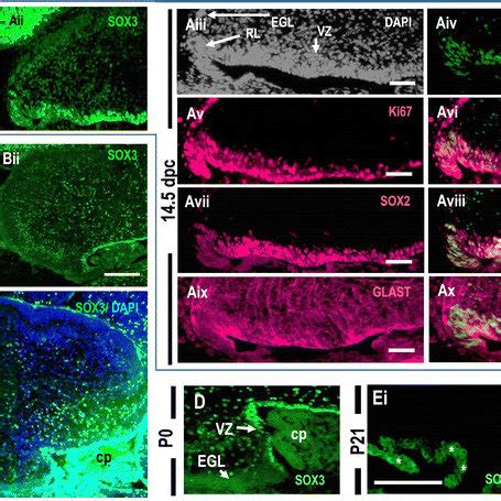 The Sox Protein Is Expressed In The Ventricular Zones Of The