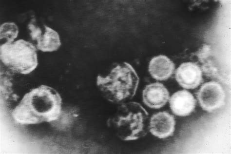 Electron Micrograph Of Epstein Barr Virus Biology Of Humanworld Of Viruses