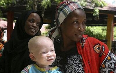 Head Down Eyes Open: A tiny sanctuary for Tanzania’s albinos