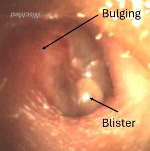 Clinical Ear Anatomy Case And Image Library WiscMed