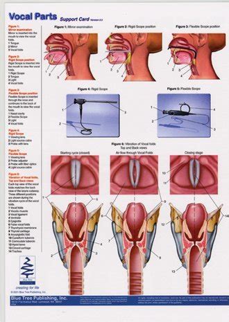 Larynx Chart A Visual Reference Of Charts Chart Master