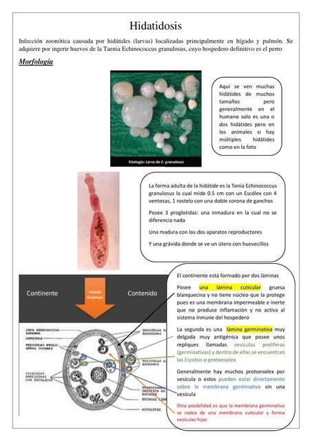 Hidatidosis Vanessa Udocz