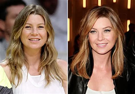 Ellen Pompeo Plastic Surgery Before and After Botox Injections | Celebie