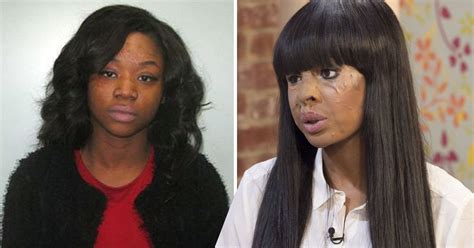 Acid Attack Naomi Oni Speaks Of Betrayal After London Attack Metro News