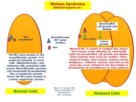 Watson Syndrome Hereditary Ocular Diseases