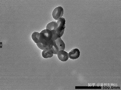 碗状纳米粒200 Nm 聚多巴胺200nm Pda纳米粒 Tem图谱 知乎