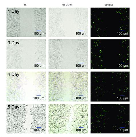 Wound Healing Assays Using U251 And Cx43 U251 Cells Download Scientific Diagram