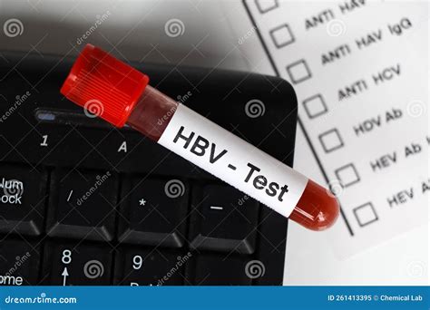 HBV Test To Look For Abnormalities From Blood Stock Image Image Of