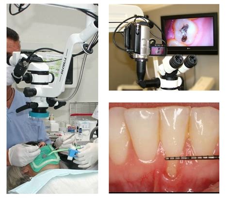 Microscope Dentistry - Dentistry Technology | Amber Dental