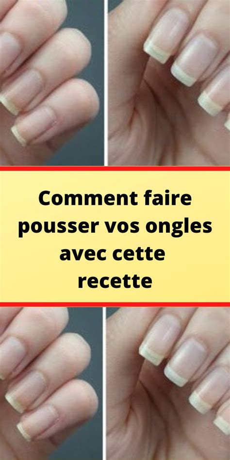 Comment Faire Pousser Vos Ongles Avec Cette Recette Haustiersos