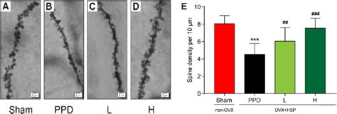 Effects Of S Ketamine On The Number Of Dendritic Spines In PPD Rats