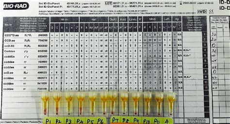 Patient Antibody Identification Panel In Ahg Phase With Antegram Ahg