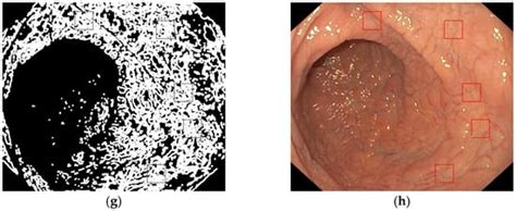 Diagnostics Free Full Text Computer Based Diagnosis Of Celiac