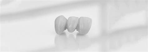 Dental Bridges For Missing Teeth Wirral Buckle Wirral Dentists