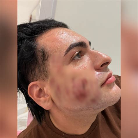 Ju Za Nega Pedido De Sigilo Em Caso De Homem Morto Ap S Peeling De