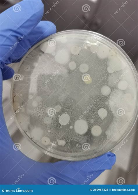 Bacterias Que Crecen En Una Placa De Agar Imagen De Archivo Imagen De