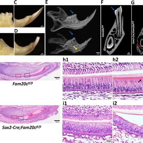 Histological Analysis Of The Enamel Defects In The Sox2 Cre Fam20Cfl Fl