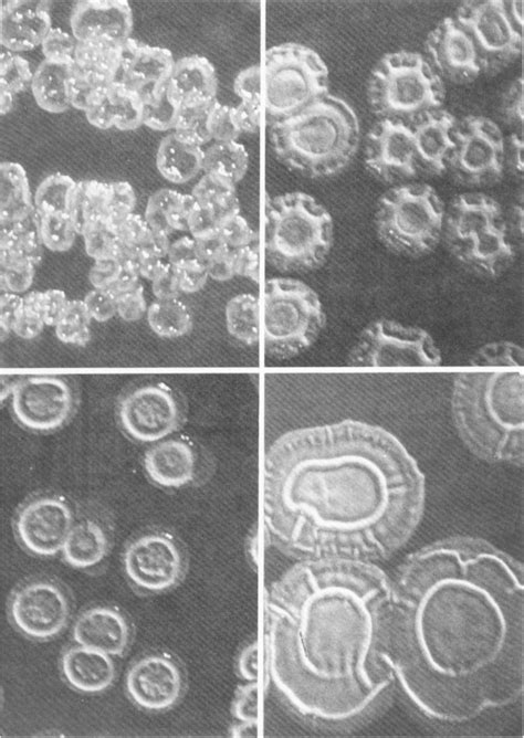 Alcaligenes Faecalis Colony Morphology