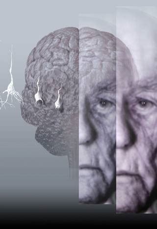 Cientistas Brasileiros Descobrem Como Prevenir Alzheimer Jornal O Globo