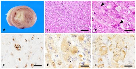 Gross Pathology Histopathology And Immunohistochemistry Of Chickens