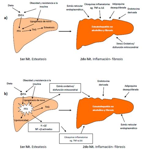 Regeneración Hepática En Enfermedad De Hígado Graso No Alcohólica Medwave