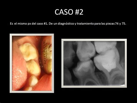 Casos Clínicos Odontopediatría