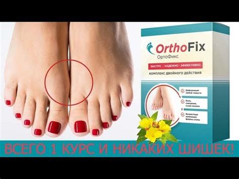 Ортофикс Цена В Аптеках | Ортофикс Отзывы Форум - YouTube
