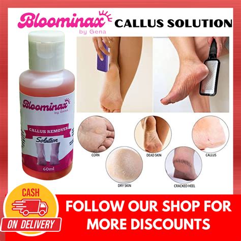 BLOOMINAX Callus Peeling Oil 60ML FREE KALYO PILE pangtanggal ng kalyo ...