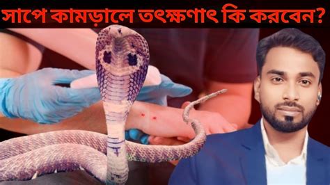 সাপে কামড়ালে তৎক্ষণাৎ কি করবেন সাপে কামড়ালে করণীয় কি কি🐍