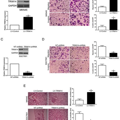 Trim Promotes Gc Cell Migration And Invasion In Vitro And In Vivo