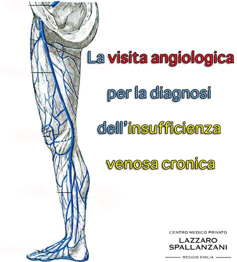 Visita Angiologica come si può diagnosticare l insufficienza venosa