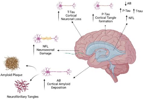 Frontiers Alzheimers Disease A Review On The Current Trends Of The