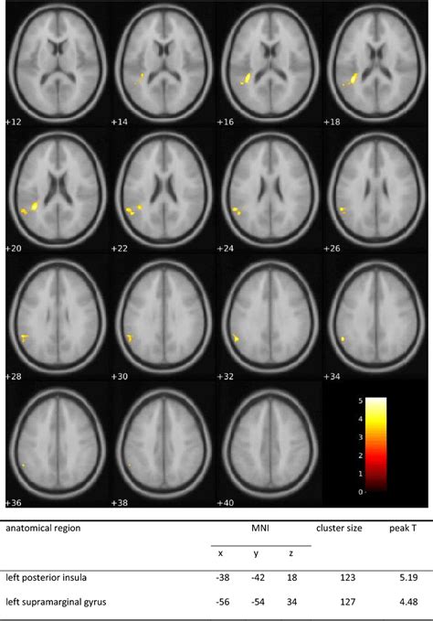 Moral Task FMRI Effects Of Substance Positive Activation Change Of