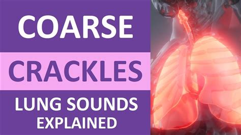 Coarse Crackles Lung Sounds Audio Causes Auscultation Nursing NCLEX