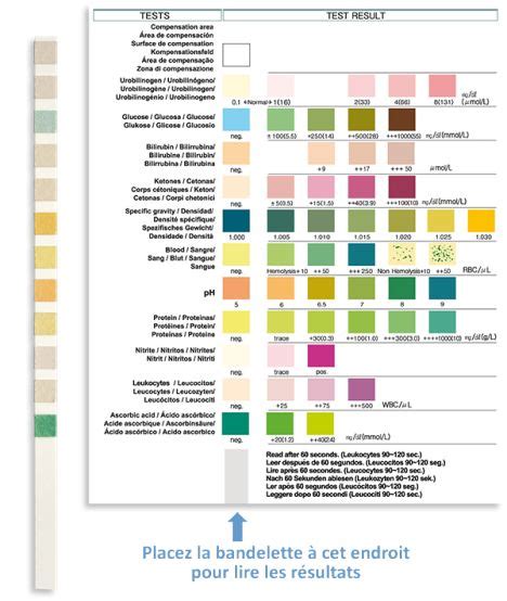 La Bandelette Urinaire Bu En Soin Infirmier Voies Biliaires